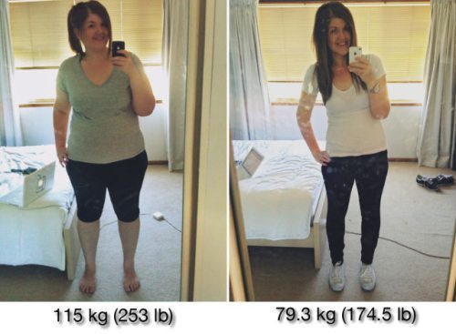 women-weight-loss-transformations-19
